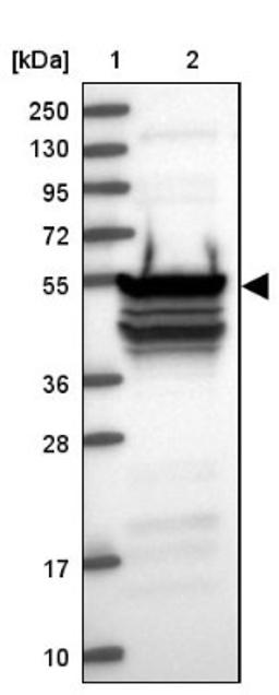 Western Blot: RBM41 Antibody [NBP1-83788] - Lane 1: Marker [kDa] 250, 130, 95, 72, 55, 36, 28, 17, 10<br/>Lane 2: Human cell line RT-4