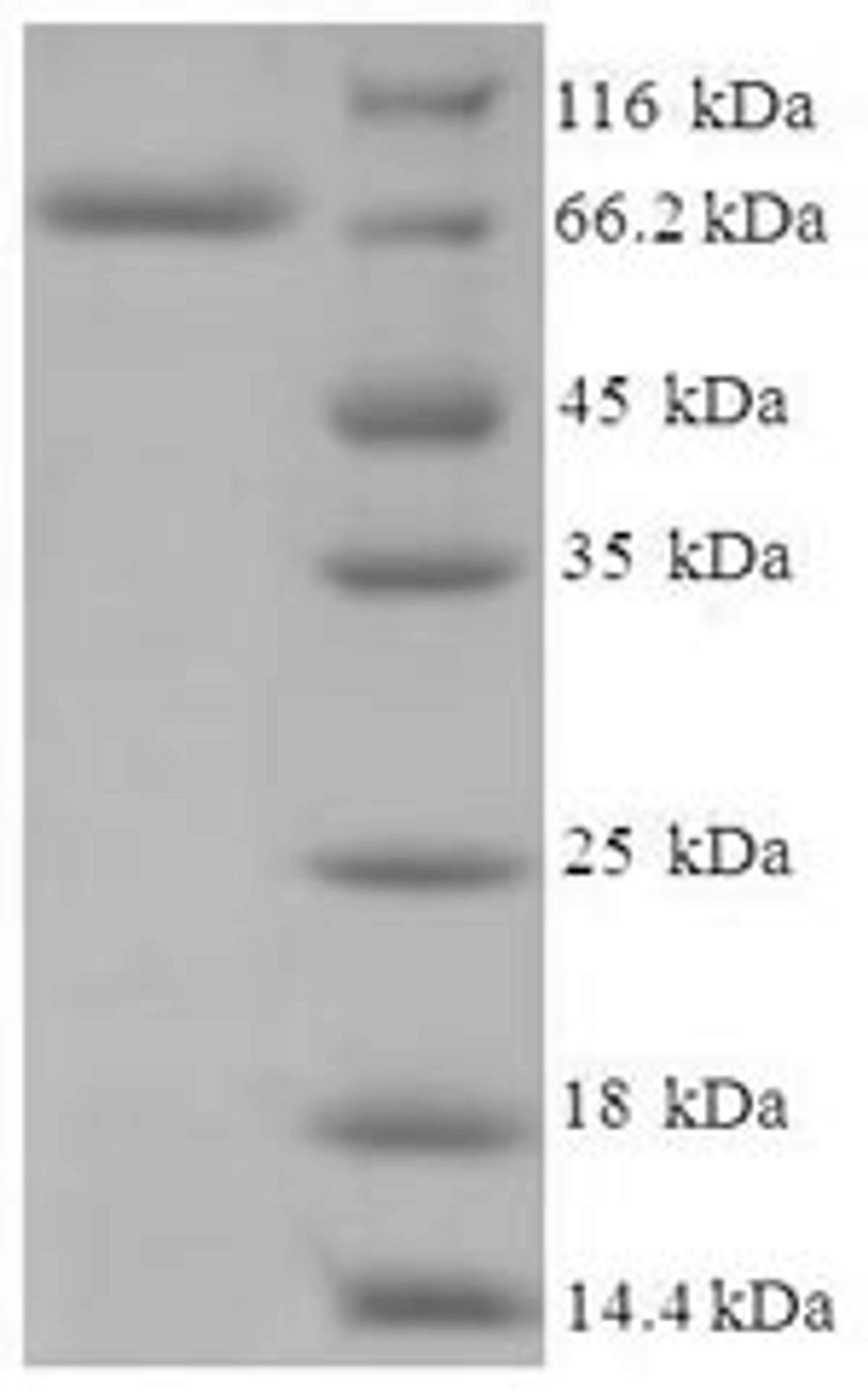 (Tris-Glycine gel) Discontinuous SDS-PAGE (reduced) with 5% enrichment gel and 15% separation gel.