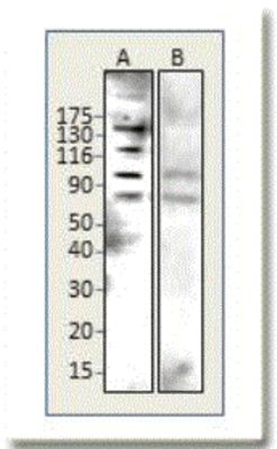 Western Blot: BTBD7 Antibody [NBP1-49652] - Lane A: Immune Serum, Lane B: Preimmune. Apparent MW is 138 kDa