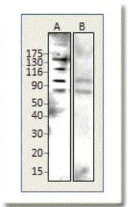 Western Blot: BTBD7 Antibody [NBP1-49652] - Lane A: Immune Serum, Lane B: Preimmune. Apparent MW is 138 kDa