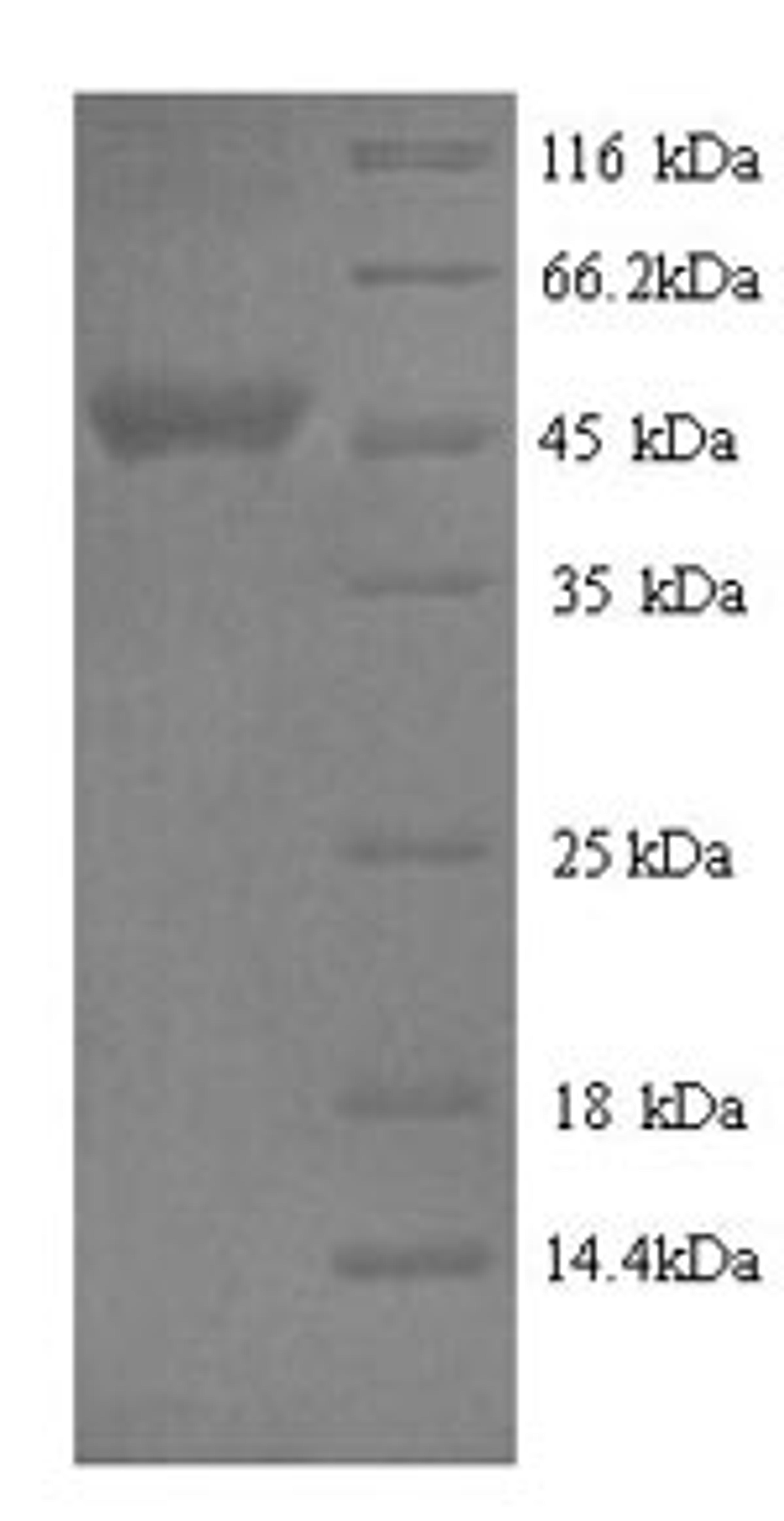 (Tris-Glycine gel) Discontinuous SDS-PAGE (reduced) with 5% enrichment gel and 15% separation gel.