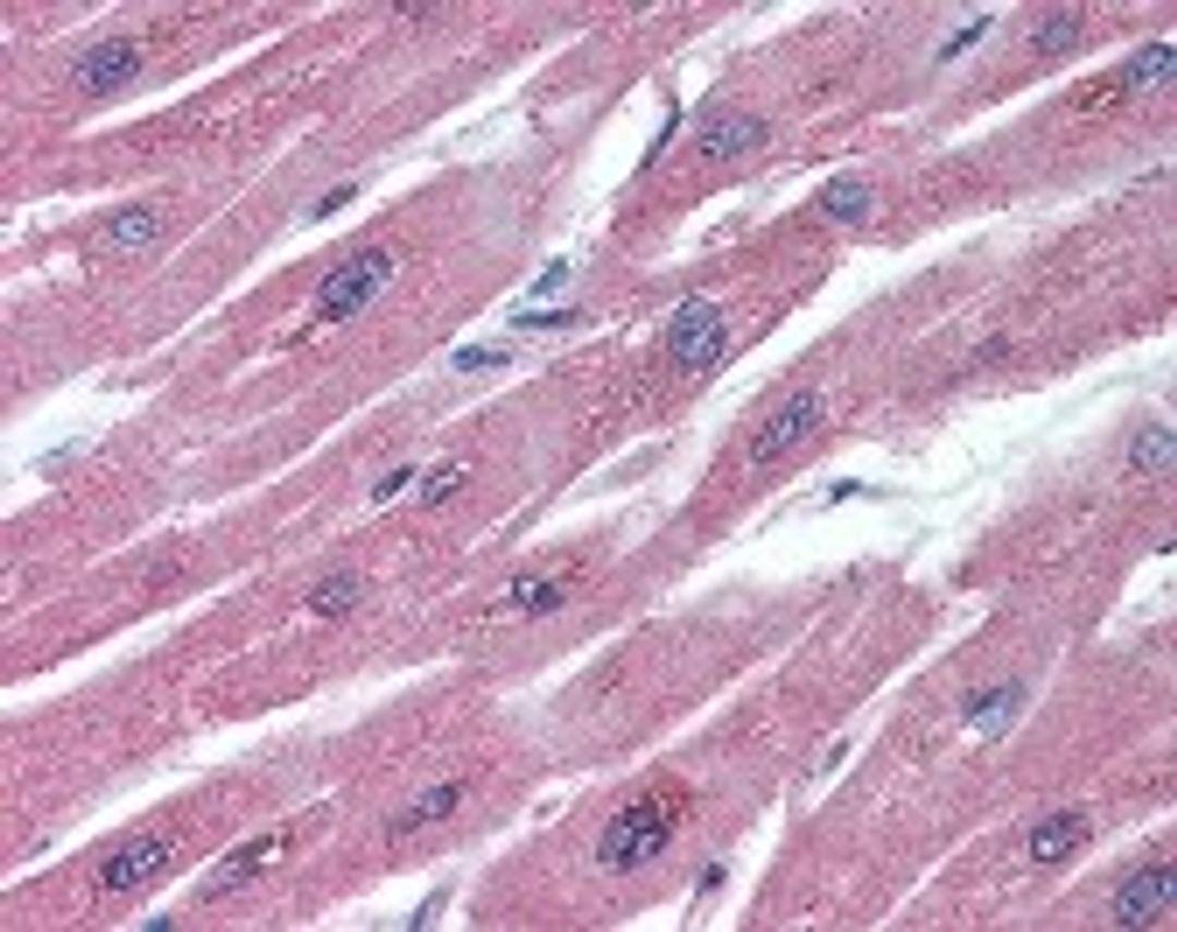 Immunohistochemistry staining of TNFRSF11B in heart formlin-fixed paraffin-embedded) tissue using TNFRSF11B monoclonal Antibody.