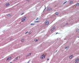 Immunohistochemistry staining of TNFRSF11B in heart formlin-fixed paraffin-embedded) tissue using TNFRSF11B monoclonal Antibody.