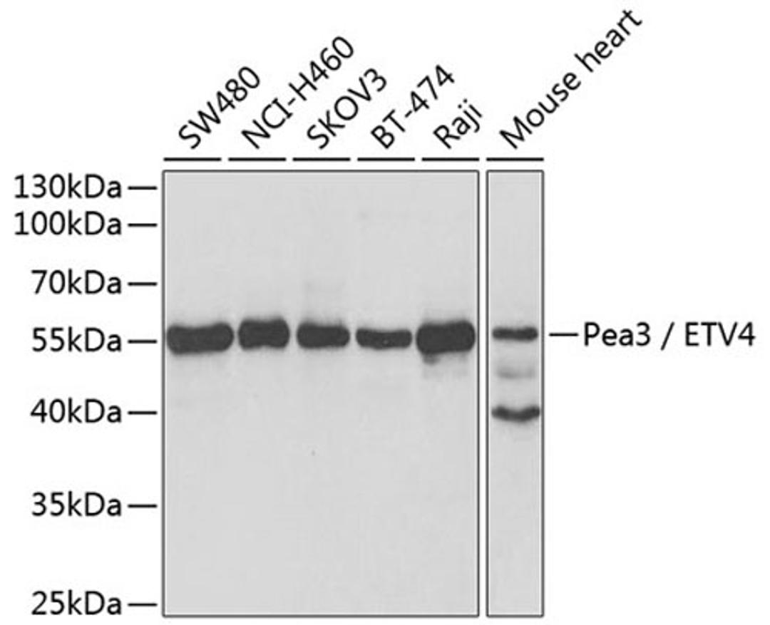 Western blot - Pea3 / ETV4 antibody (A5797)