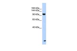 Antibody used in WB on Human Muscle at 0.2-1 ug/ml.