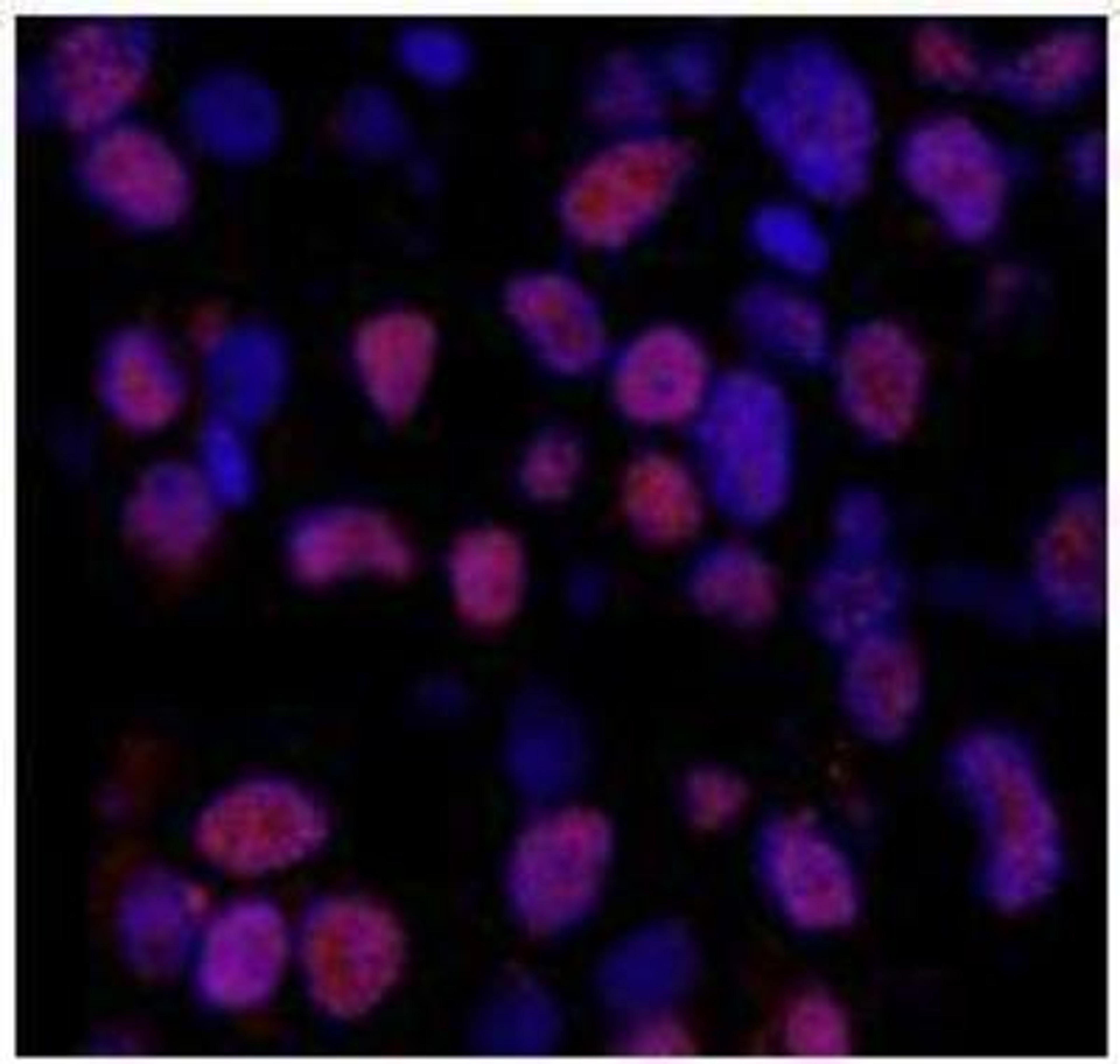 Immunocytochemistry/Immunofluorescence: XRCC1 [p Ser518, p Thr519, p Thr523] Antibody [NB100-532] - See Internal Notes ICC caption