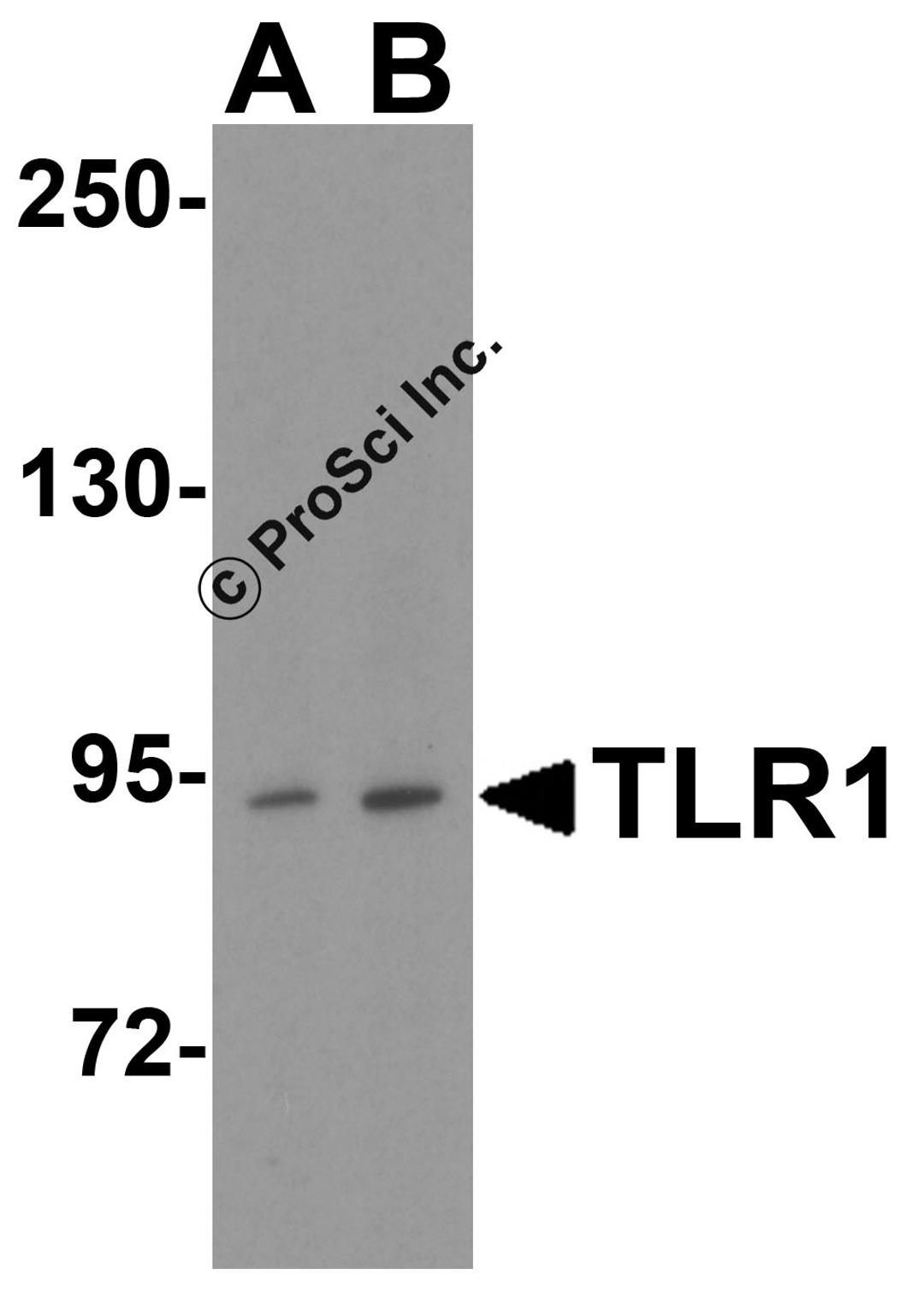 Western blot analysis of TLR1 in THP-1 cell lysate with TLR1 antibody at (A) 1 and (B) 2 &#956;g/mL.