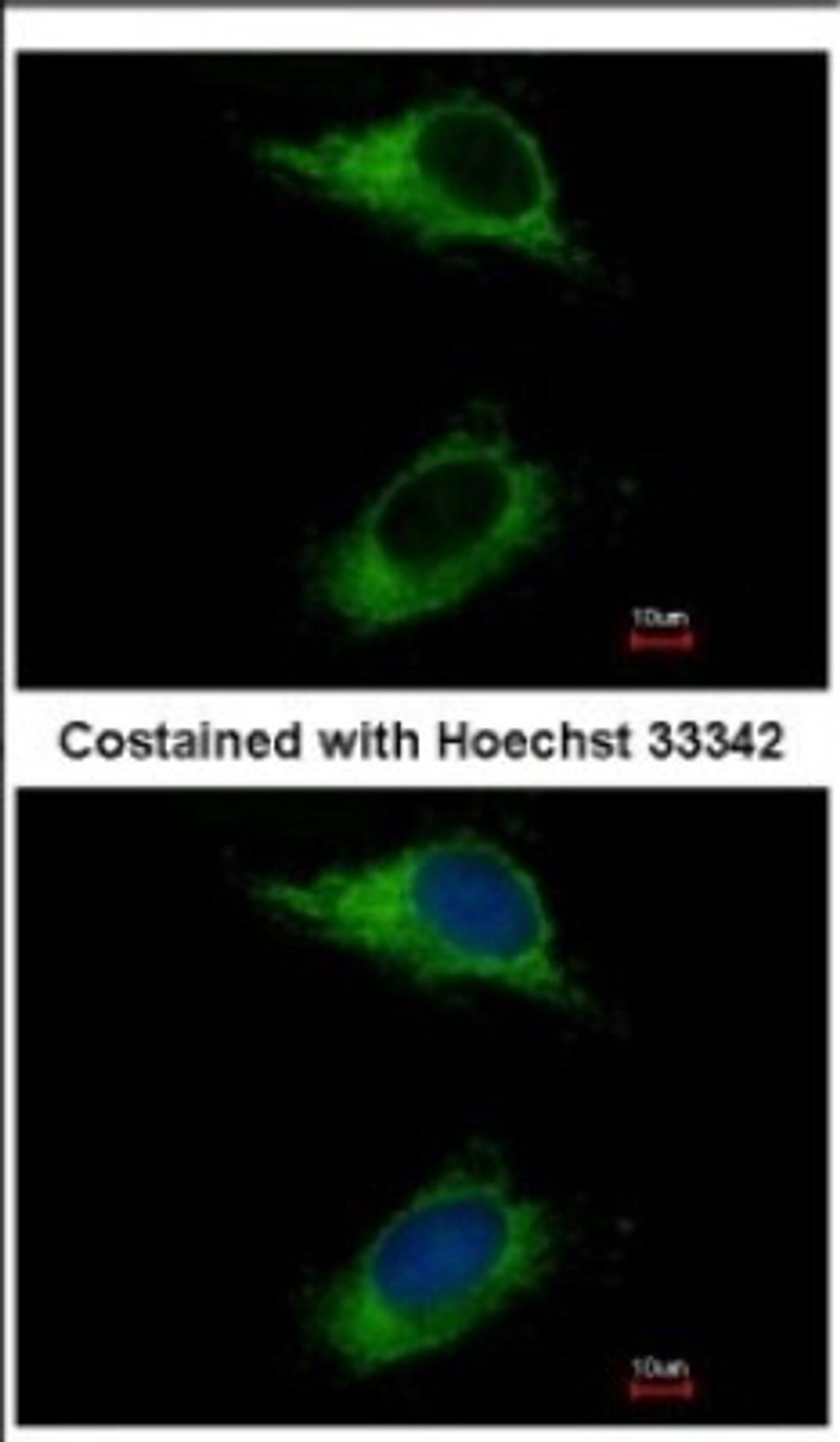 Immunocytochemistry/Immunofluorescence: CARD6 Antibody [NBP2-15704] - Immunofluorescence analysis of methanol-fixed HeLa, using antibody at 1:500 dilution.