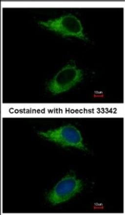 Immunocytochemistry/Immunofluorescence: CARD6 Antibody [NBP2-15704] - Immunofluorescence analysis of methanol-fixed HeLa, using antibody at 1:500 dilution.