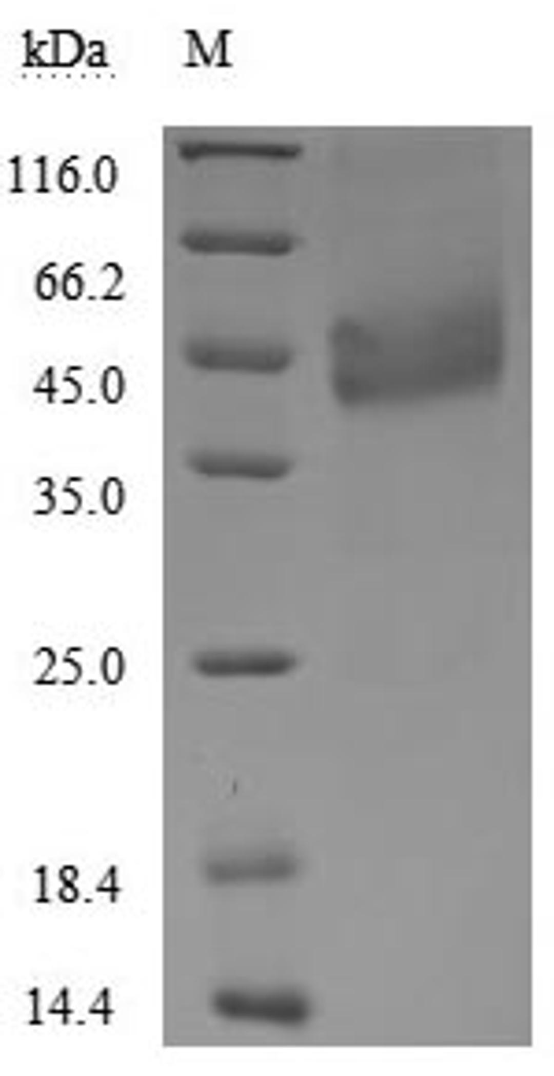 (Tris-Glycine gel) Discontinuous SDS-PAGE (reduced) with 5% enrichment gel and 15% separation gel.