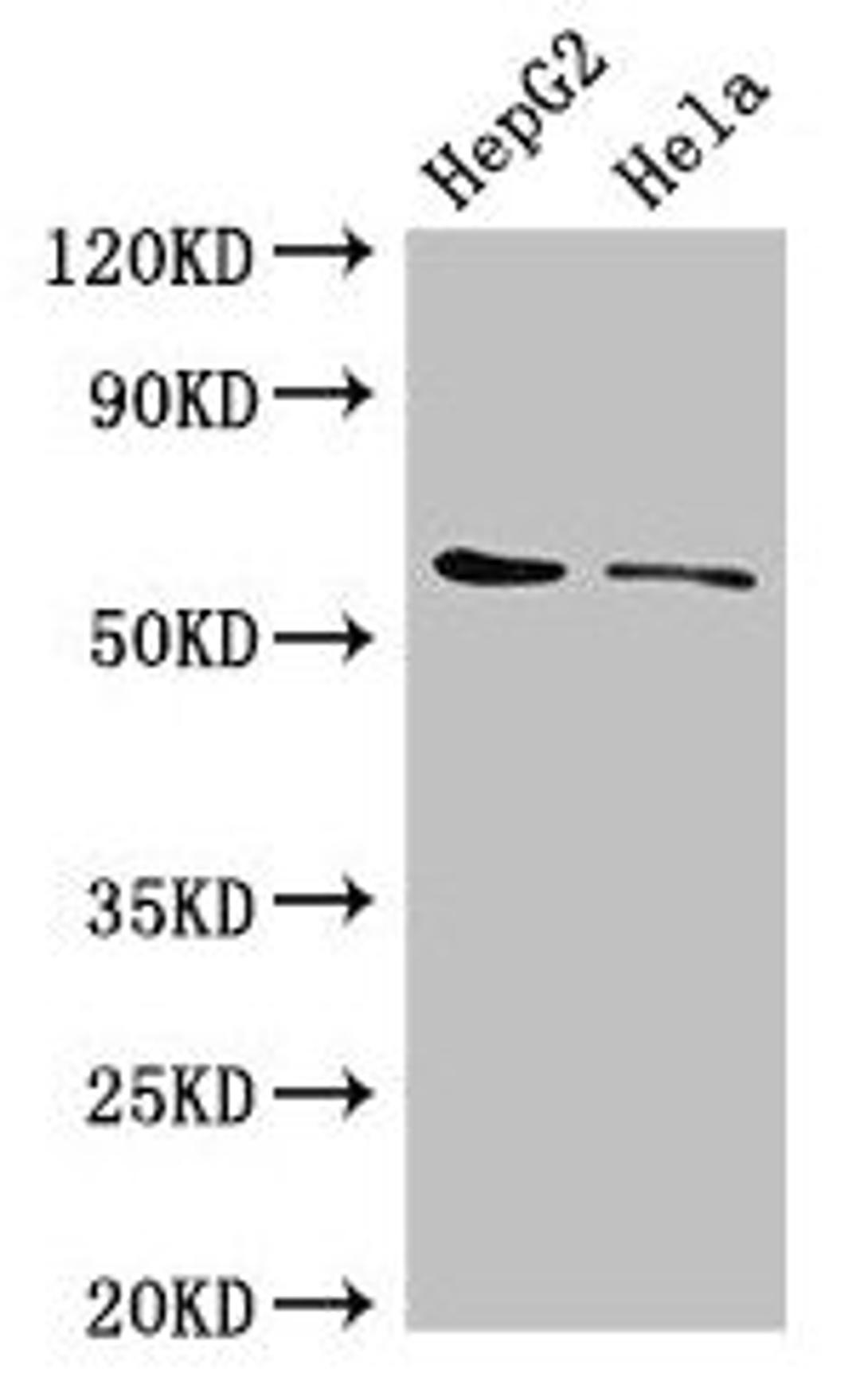 Western Blot. Positive WB detected in: HepG2 whole cell lysate, Hela whole cell lysate. All lanes: CDT1 antibody at 3µg/ml. Secondary. Goat polyclonal to rabbit IgG at 1/50000 dilution. Predicted band size: 61 kDa. Observed band size: 61 kDa