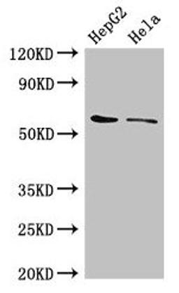 Western Blot. Positive WB detected in: HepG2 whole cell lysate, Hela whole cell lysate. All lanes: CDT1 antibody at 3µg/ml. Secondary. Goat polyclonal to rabbit IgG at 1/50000 dilution. Predicted band size: 61 kDa. Observed band size: 61 kDa
