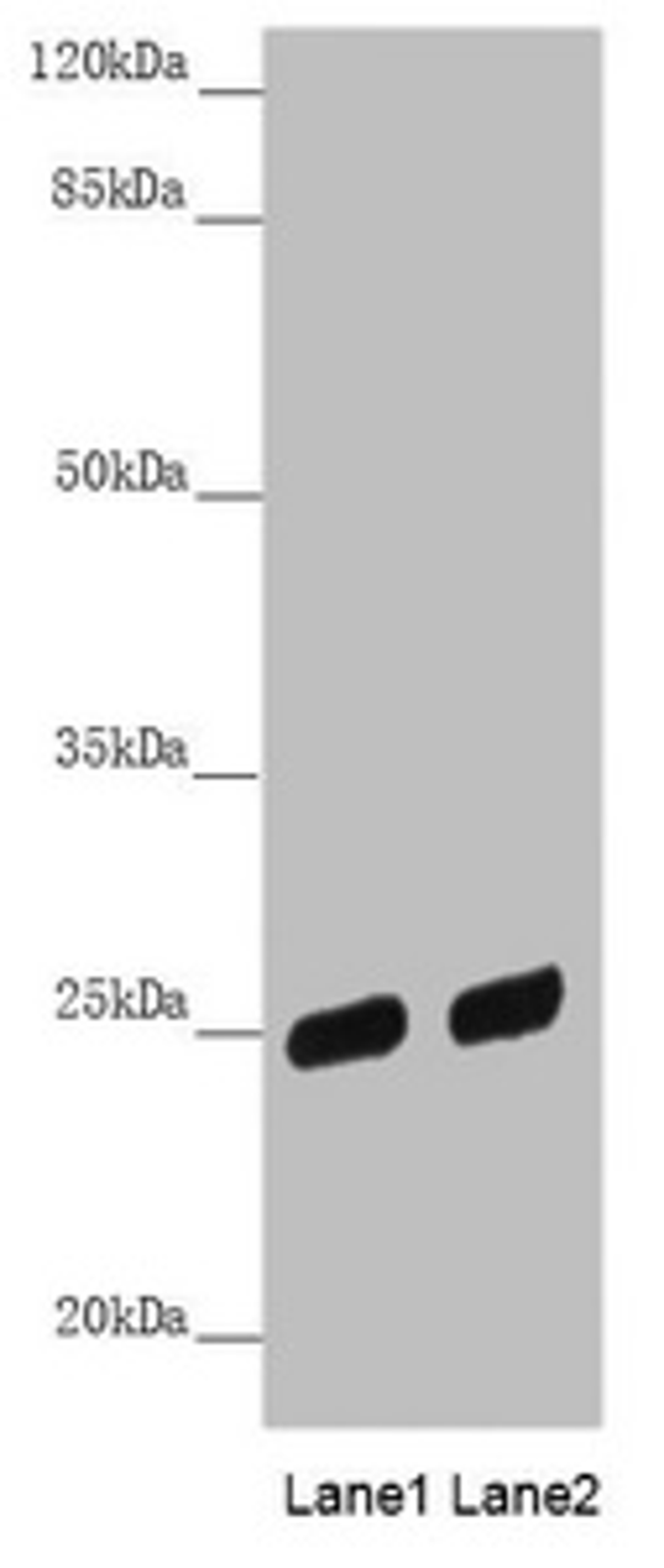 Western blot. All lanes: PSPH antibody at 3.81µg/ml. Lane 1: HL60 whole cell lysate. Lane 2: A431 whole cell lysate. Secondary. Goat polyclonal to rabbit IgG at 1/10000 dilution. Predicted band size: 25 kDa. Observed band size: 25 kDa