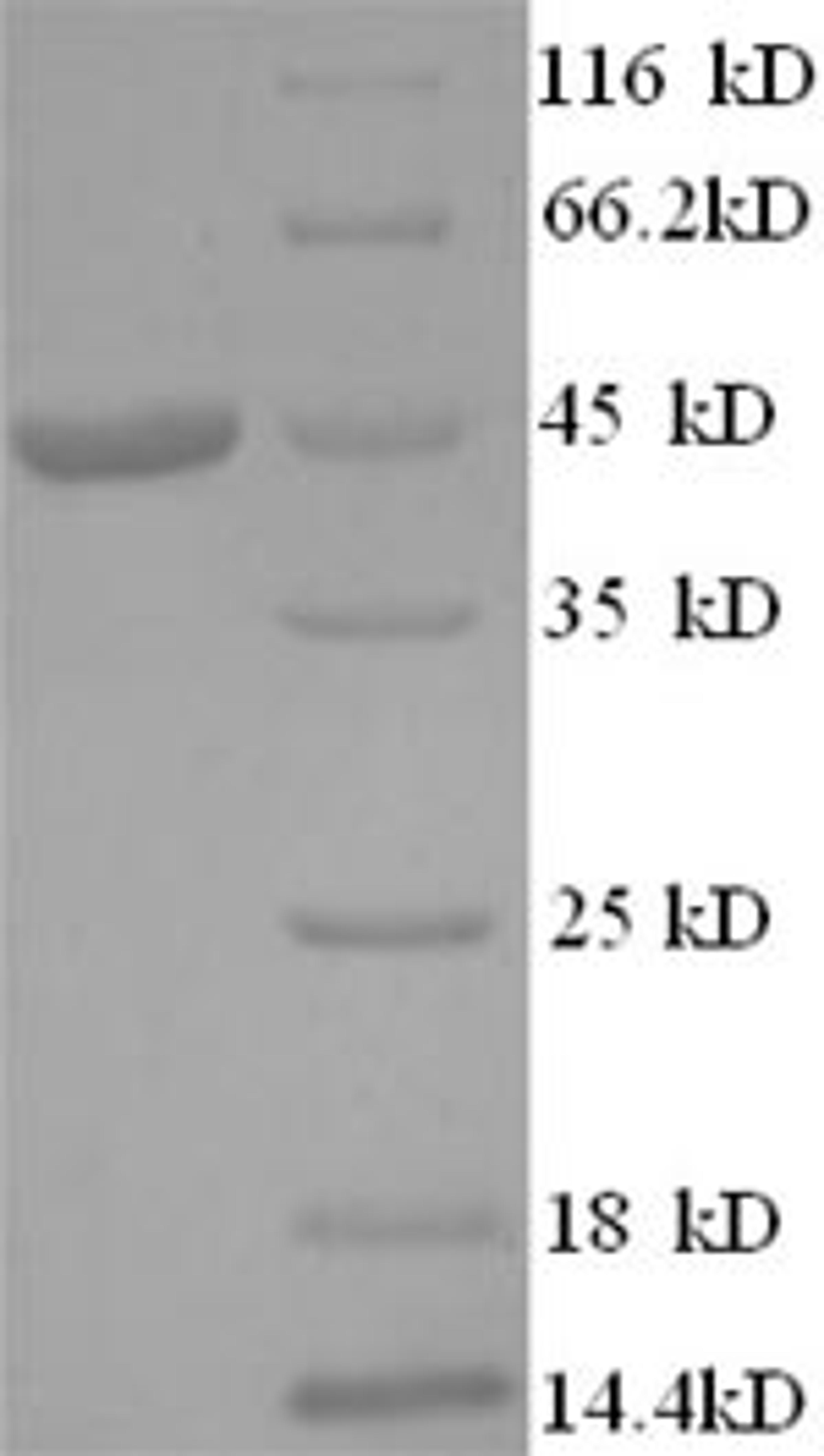 (Tris-Glycine gel) Discontinuous SDS-PAGE (reduced) with 5% enrichment gel and 15% separation gel.