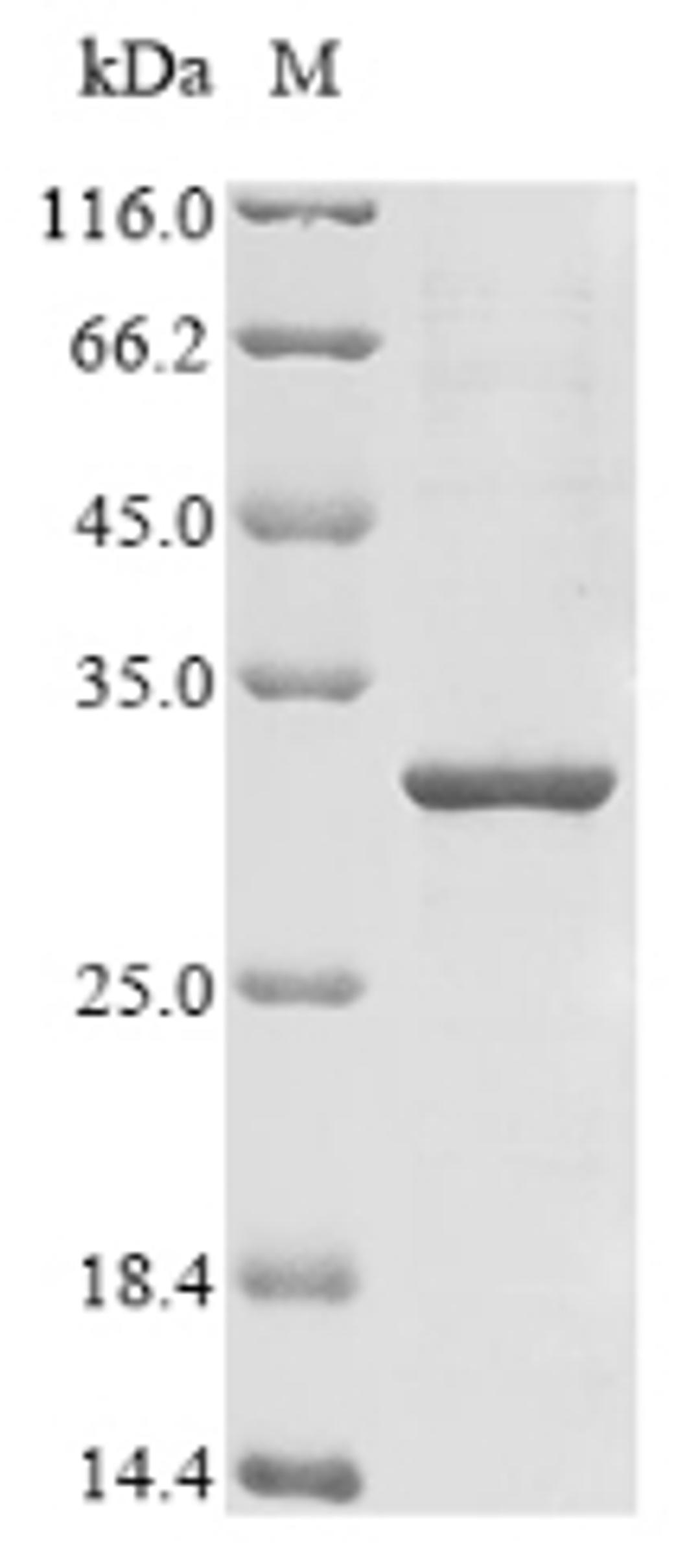 (Tris-Glycine gel) Discontinuous SDS-PAGE (reduced) with 5% enrichment gel and 15% separation gel.