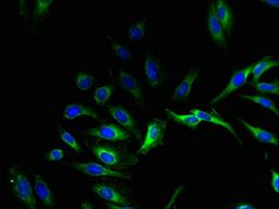 Immunofluorescent analysis of Hela cells using CSB-PA848417LA01HU at dilution of 1:100 and Alexa Fluor 488-congugated AffiniPure Goat Anti-Rabbit IgG(H+L)