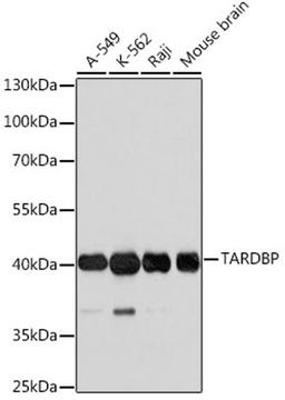 Western blot - TARDBP antibody (A0538)