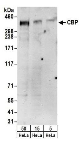 Detection of human CBP by western blot.