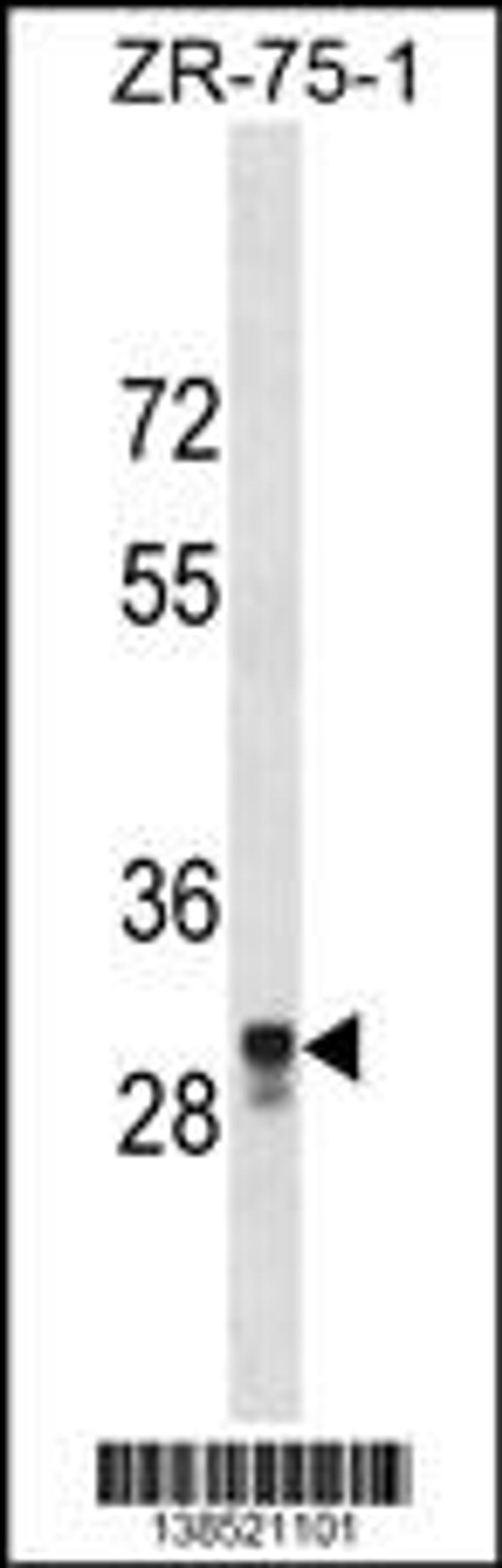 Western blot analysis in ZR-75-1 cell line lysates (35ug/lane).