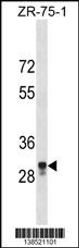 Western blot analysis in ZR-75-1 cell line lysates (35ug/lane).