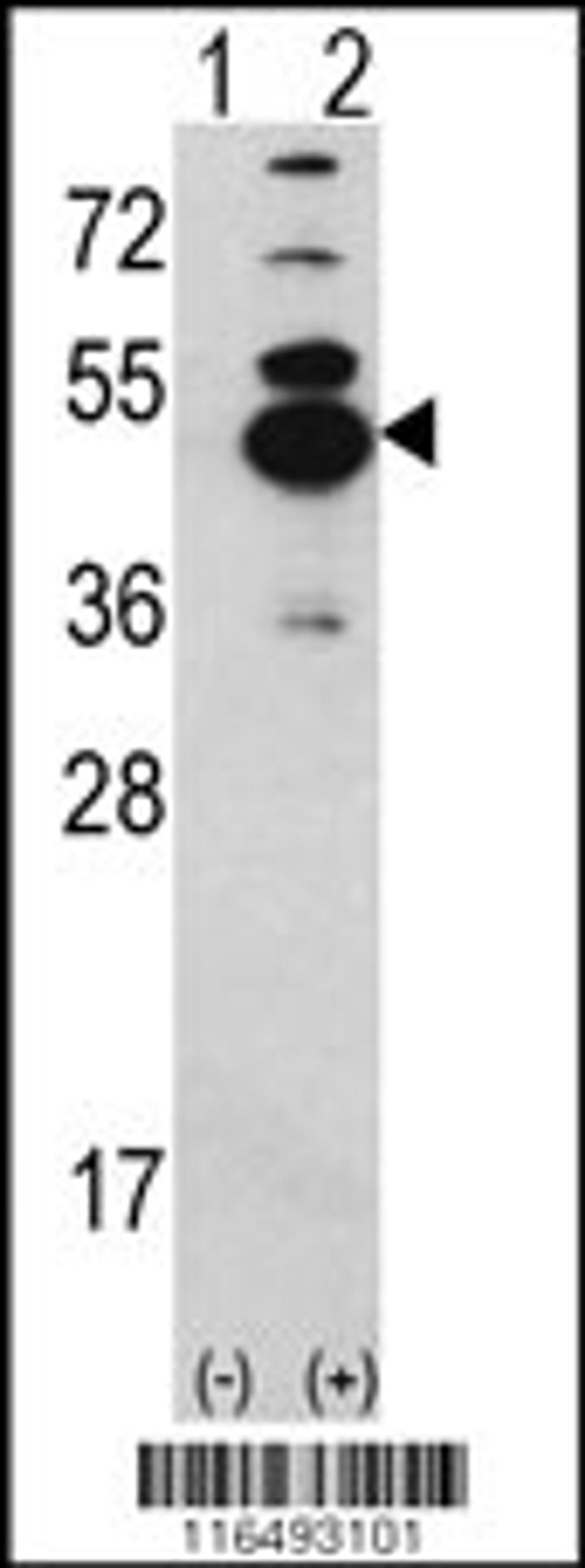 Western blot analysis of CAMK1D using rabbit polyclonal CAMK1D Antibody using 293 cell lysates (2 ug/lane) either nontransfected (Lane 1) or transiently transfected with the CAMK1D gene (Lane 2).