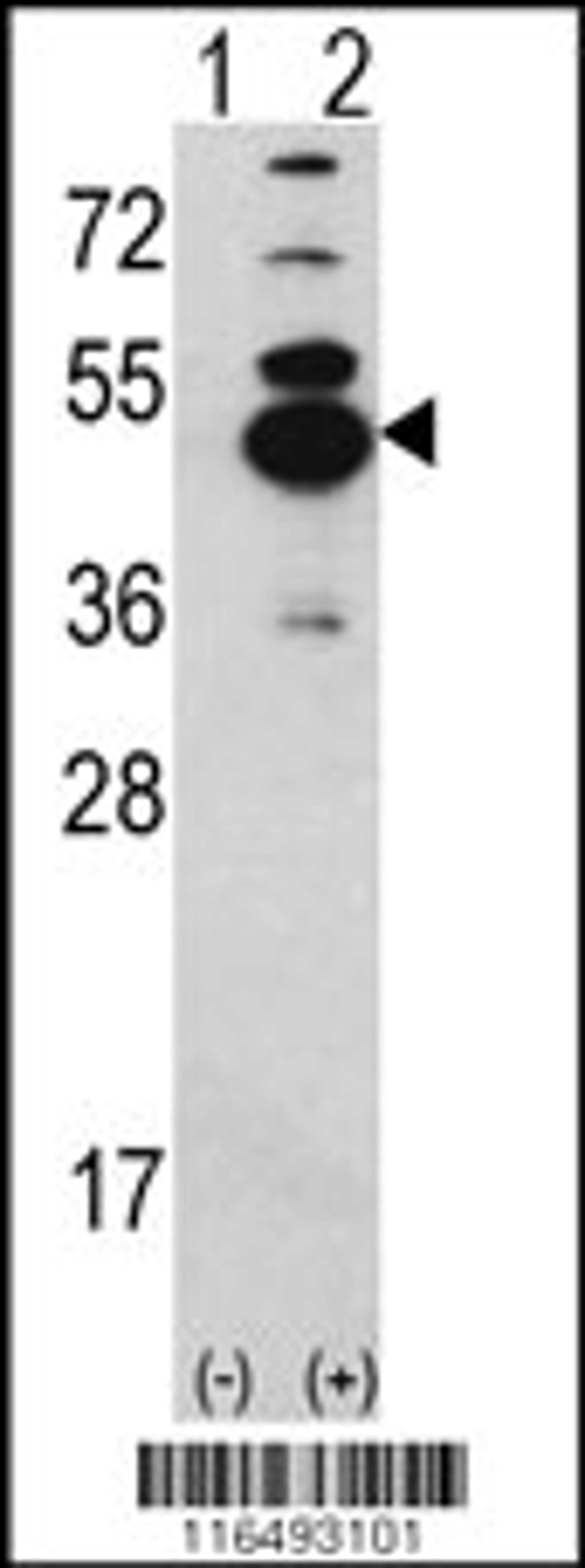 Western blot analysis of CAMK1D using rabbit polyclonal CAMK1D Antibody using 293 cell lysates (2 ug/lane) either nontransfected (Lane 1) or transiently transfected with the CAMK1D gene (Lane 2).