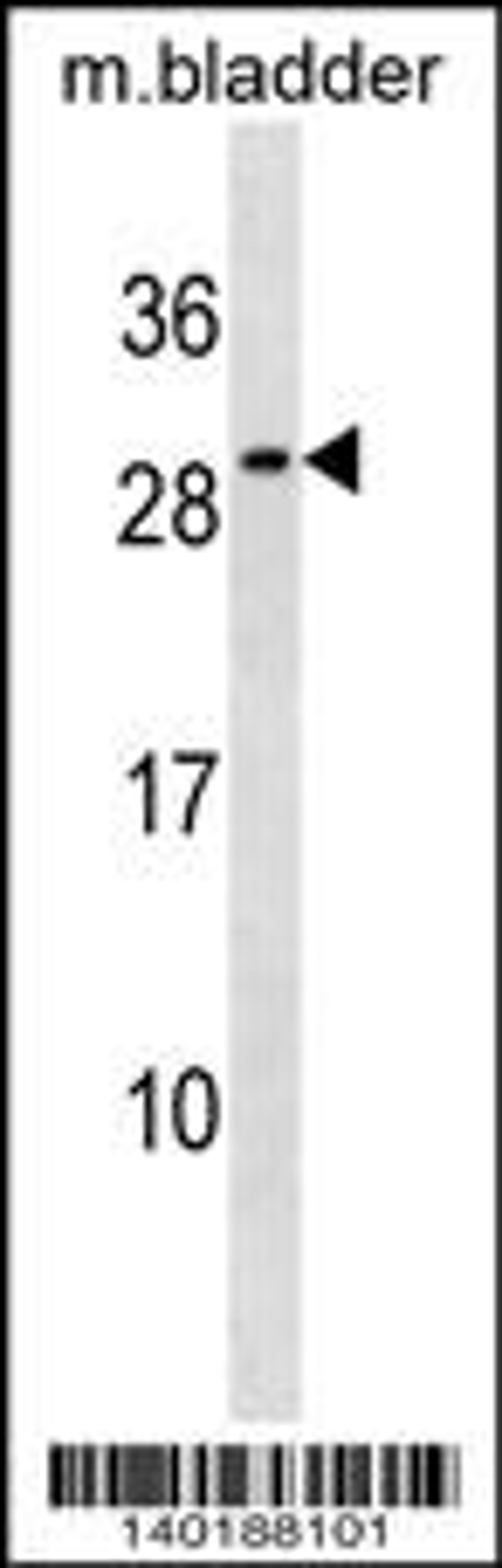 Western blot analysis in mouse bladder tissue lysates (35ug/lane).