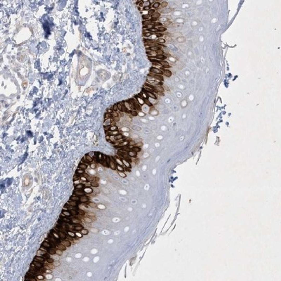 Immunohistochemistry: CCDC24 Antibody [NBP2-34179] - Immunohistochemical staining of human skin shows strong cytoplasmic positivity in basal layers of epidermal cells.