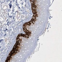 Immunohistochemistry: CCDC24 Antibody [NBP2-34179] - Immunohistochemical staining of human skin shows strong cytoplasmic positivity in basal layers of epidermal cells.