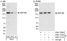 Detection of human ZNF198 by western blot and immunoprecipitation.