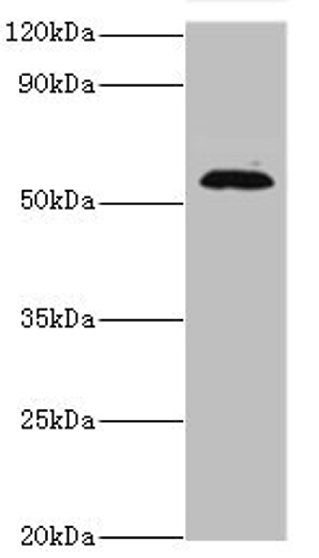 Western blot. All lanes: TSEN2 antibody at 5ug/ml + 293T whole cell lysate. Secondary. Goat polyclonal to rabbit IgG at 1/10000 dilution. Predicted band size: 54, 52, 50, 48, 46 kDa. Observed band size: 54 kDa. 