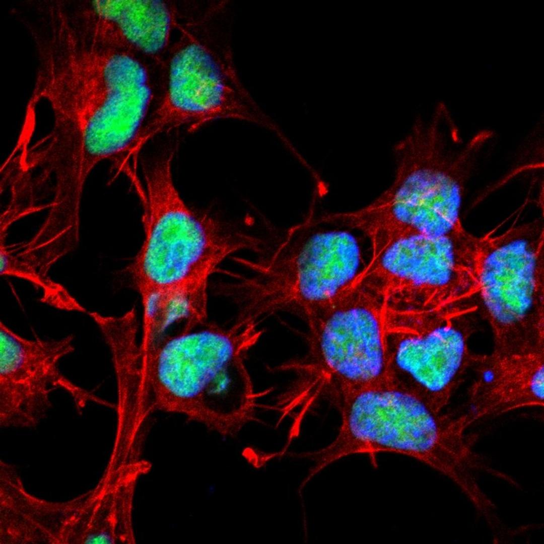 Immunofluorescence analysis of neuroblastoma cell line sk-n-be using Choline O-acetyltransferase antibody