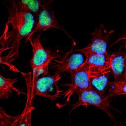 Immunofluorescence analysis of neuroblastoma cell line sk-n-be using Choline O-acetyltransferase antibody