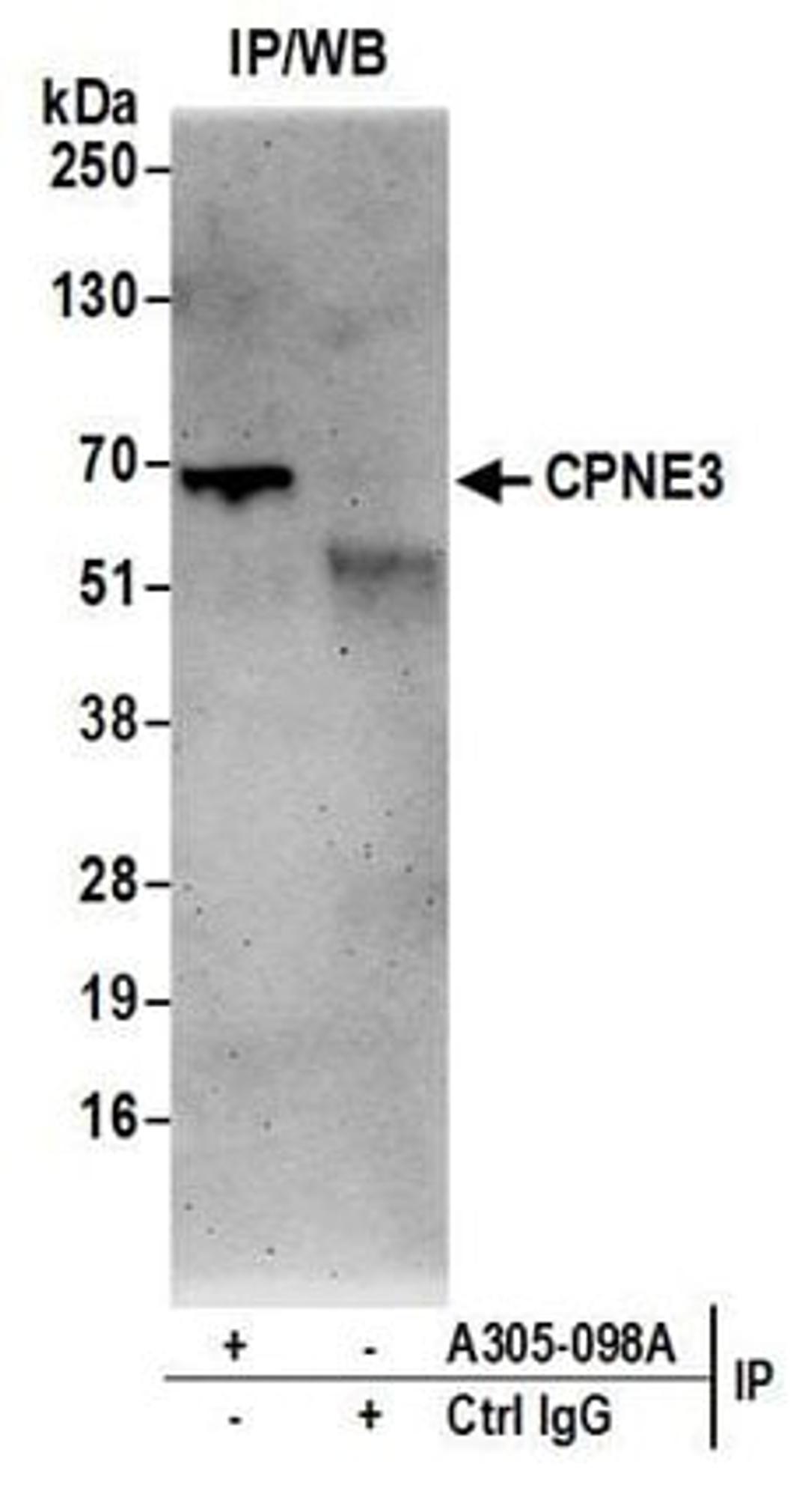 Detection of human CPNE3 by western blot of immunoprecipitates.