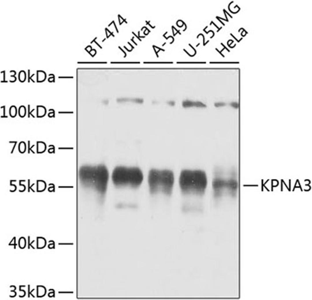 Western blot - KPNA3 antibody (A8347)