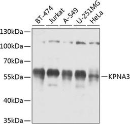 Western blot - KPNA3 antibody (A8347)