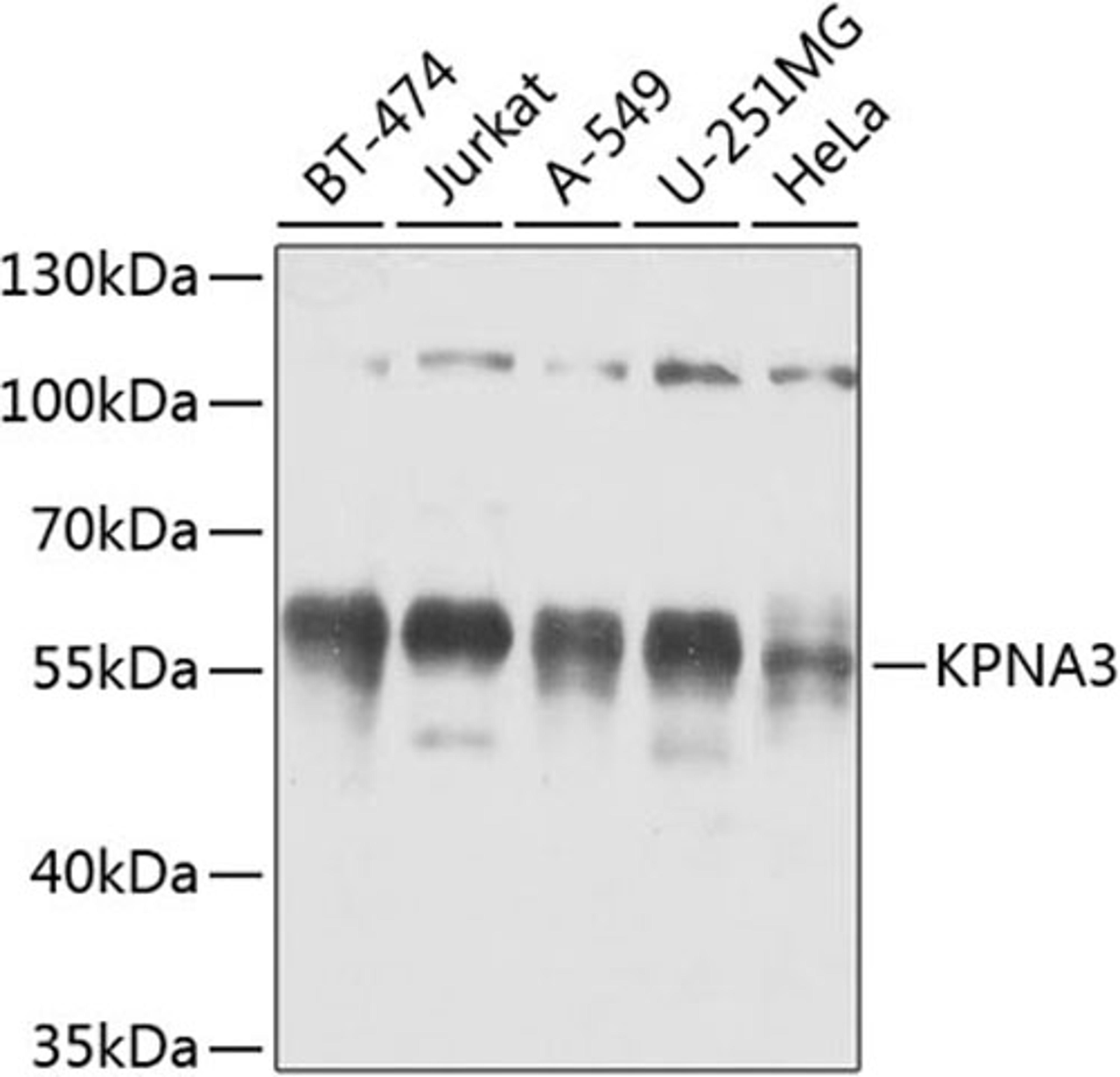 Western blot - KPNA3 antibody (A8347)