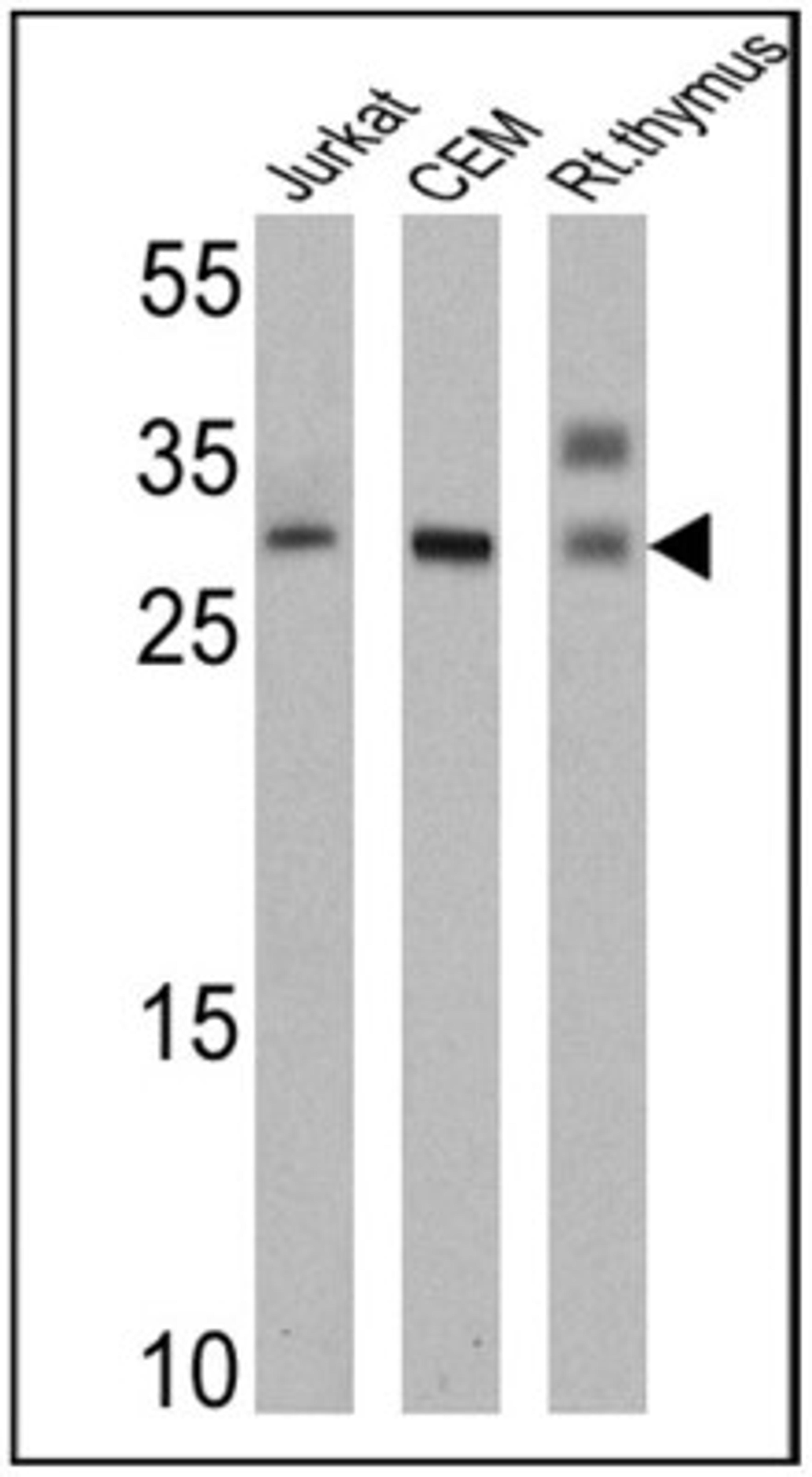 Western Blot: TCR V alpha 12.1 Antibody (6D6.6) [NBP2-22491] - Analysis of 25 ug of Jurkat (lane 1), CEM (lane 2) and rat thymus (lane 3) cell lysates.