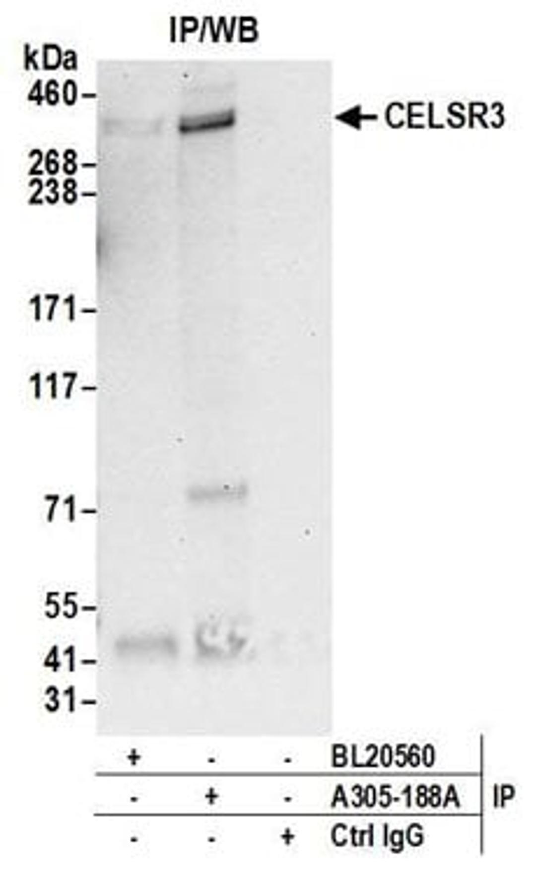 Detection of human CELSR3 by western blot of immunoprecipitates.