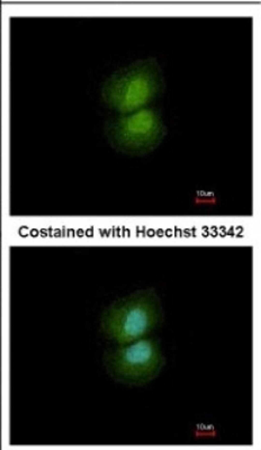 Immunocytochemistry/Immunofluorescence: YF5 Antibody [NBP2-21571] - Immunofluorescence analysis of paraformaldehyde-fixed A431, using antibody at 1:500 dilution.