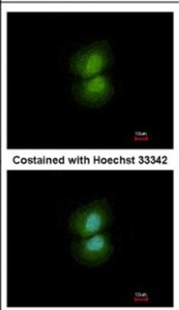 Immunocytochemistry/Immunofluorescence: YF5 Antibody [NBP2-21571] - Immunofluorescence analysis of paraformaldehyde-fixed A431, using antibody at 1:500 dilution.