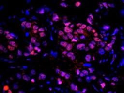 Detection of human RAP80 by immunohistochemistry.