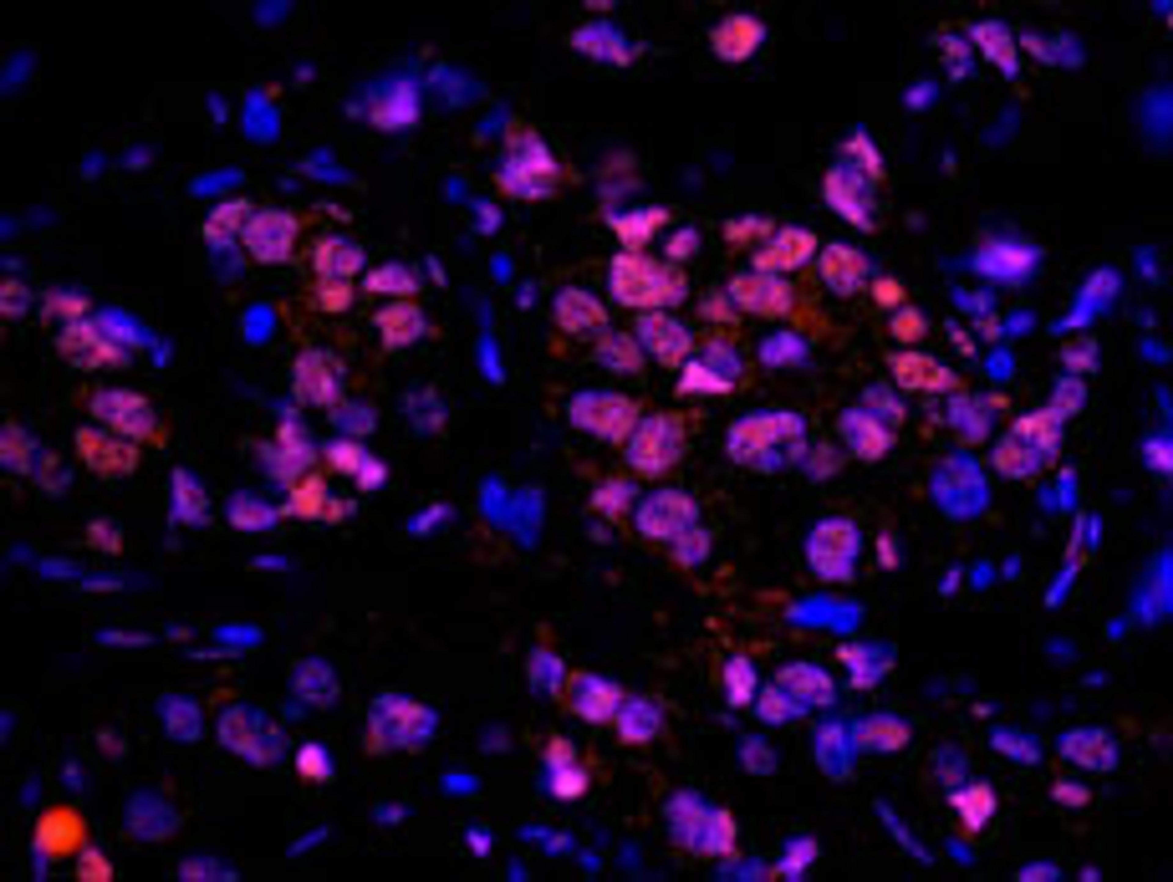 Detection of human RAP80 by immunohistochemistry.