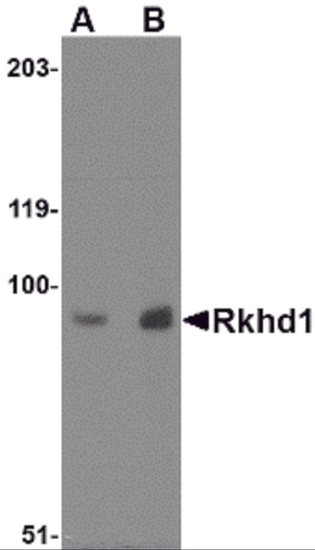 Western blot analysis of Rkhd1 in MDA-MB-361 cell lysate with Rkhd1 antibody at (A) 1 &#956;g/ml and (B) 2 &#956;g/mL.