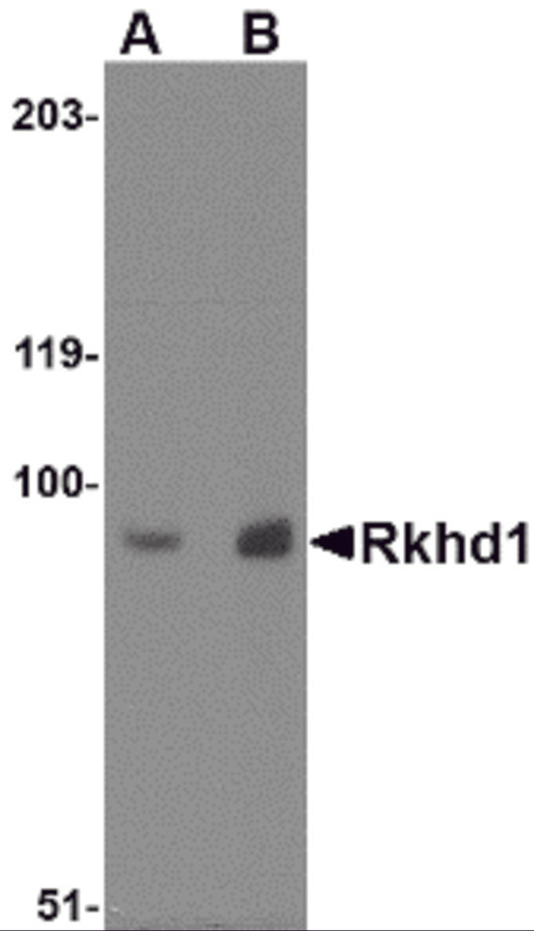 Western blot analysis of Rkhd1 in MDA-MB-361 cell lysate with Rkhd1 antibody at (A) 1 μg/ml and (B) 2 μg/mL.