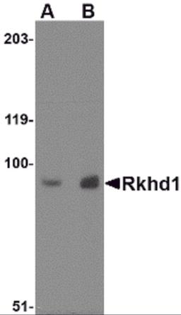 Western blot analysis of Rkhd1 in MDA-MB-361 cell lysate with Rkhd1 antibody at (A) 1 μg/ml and (B) 2 μg/mL.