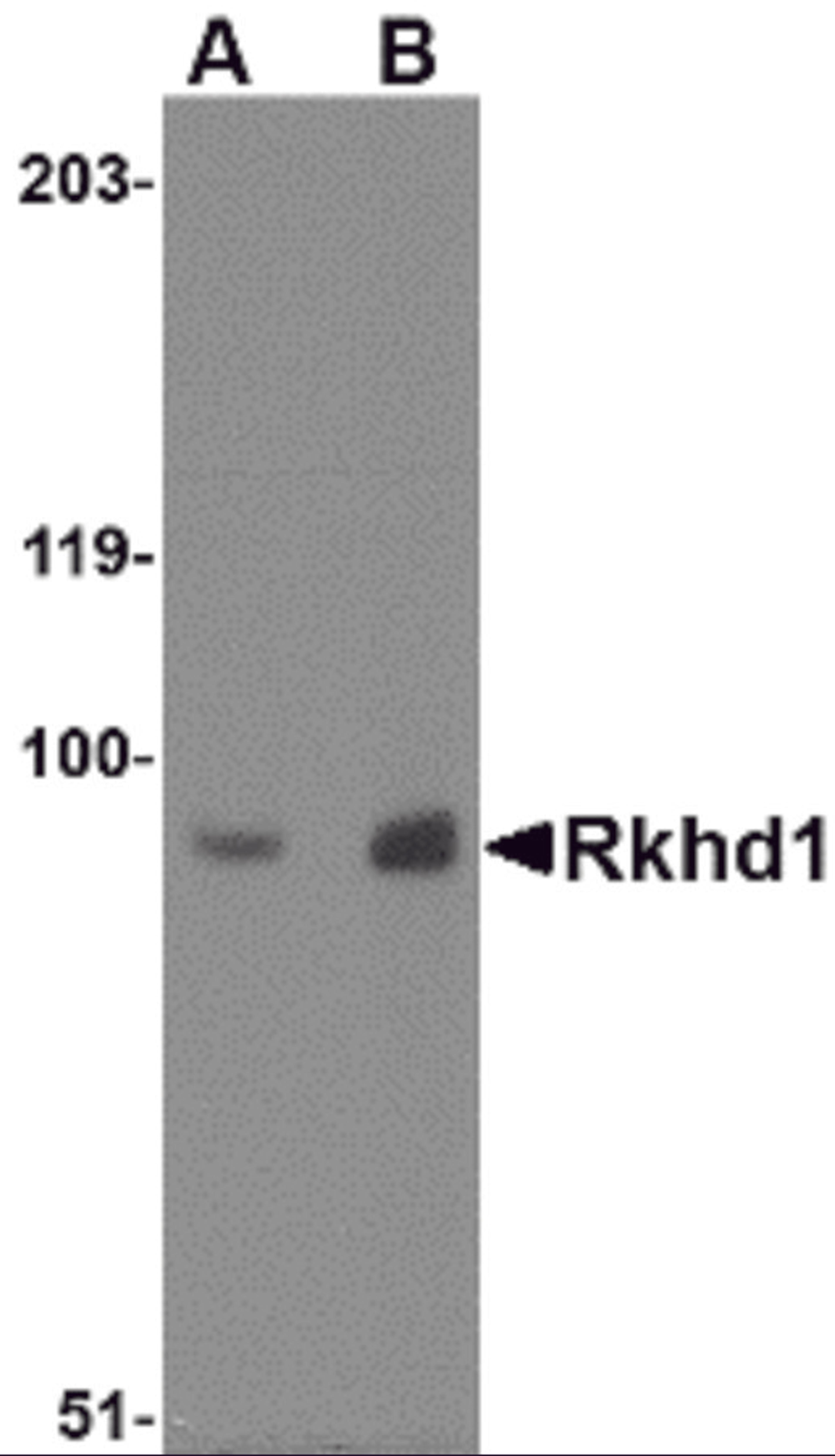 Western blot analysis of Rkhd1 in MDA-MB-361 cell lysate with Rkhd1 antibody at (A) 1 μg/ml and (B) 2 μg/mL.