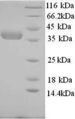 (Tris-Glycine gel) Discontinuous SDS-PAGE (reduced) with 5% enrichment gel and 15% separation gel.