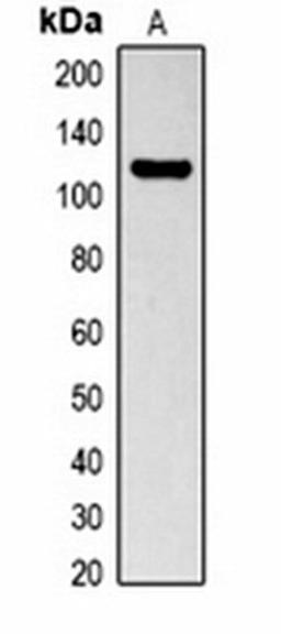 Western blot analysis of recombinant LexA protein (Lane1) whole cell lysates using LexA DNA Binding Region antibody