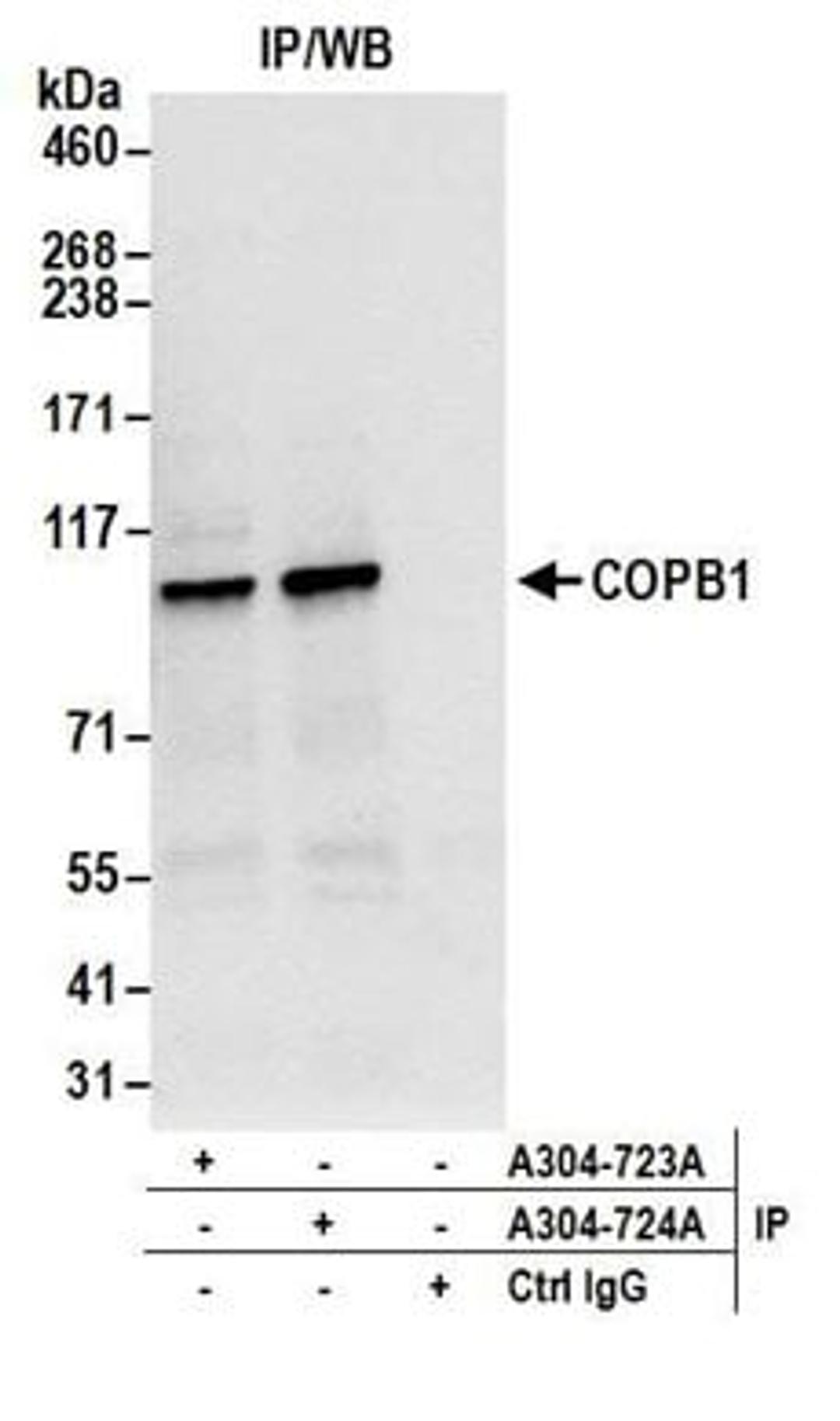 Detection of human COPB1 by western blot of immunoprecipitates.